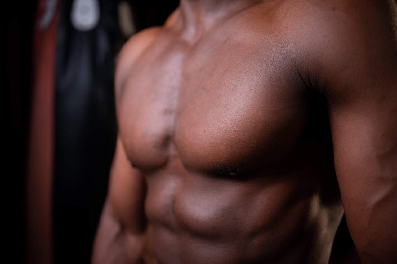 Bodybuilder Gynecomastia Surgery