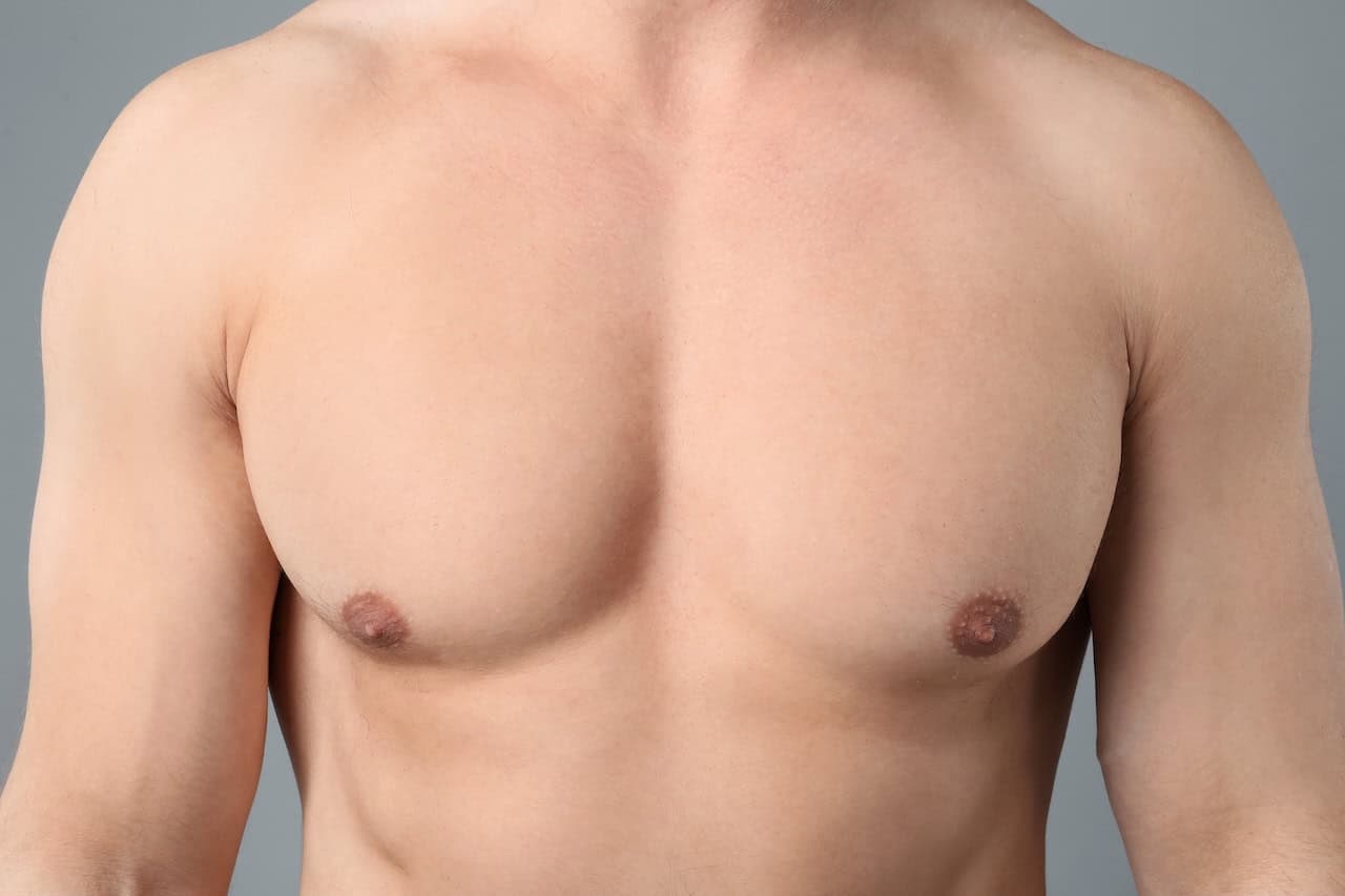 Bodybuilder Gynecomastia Surgery