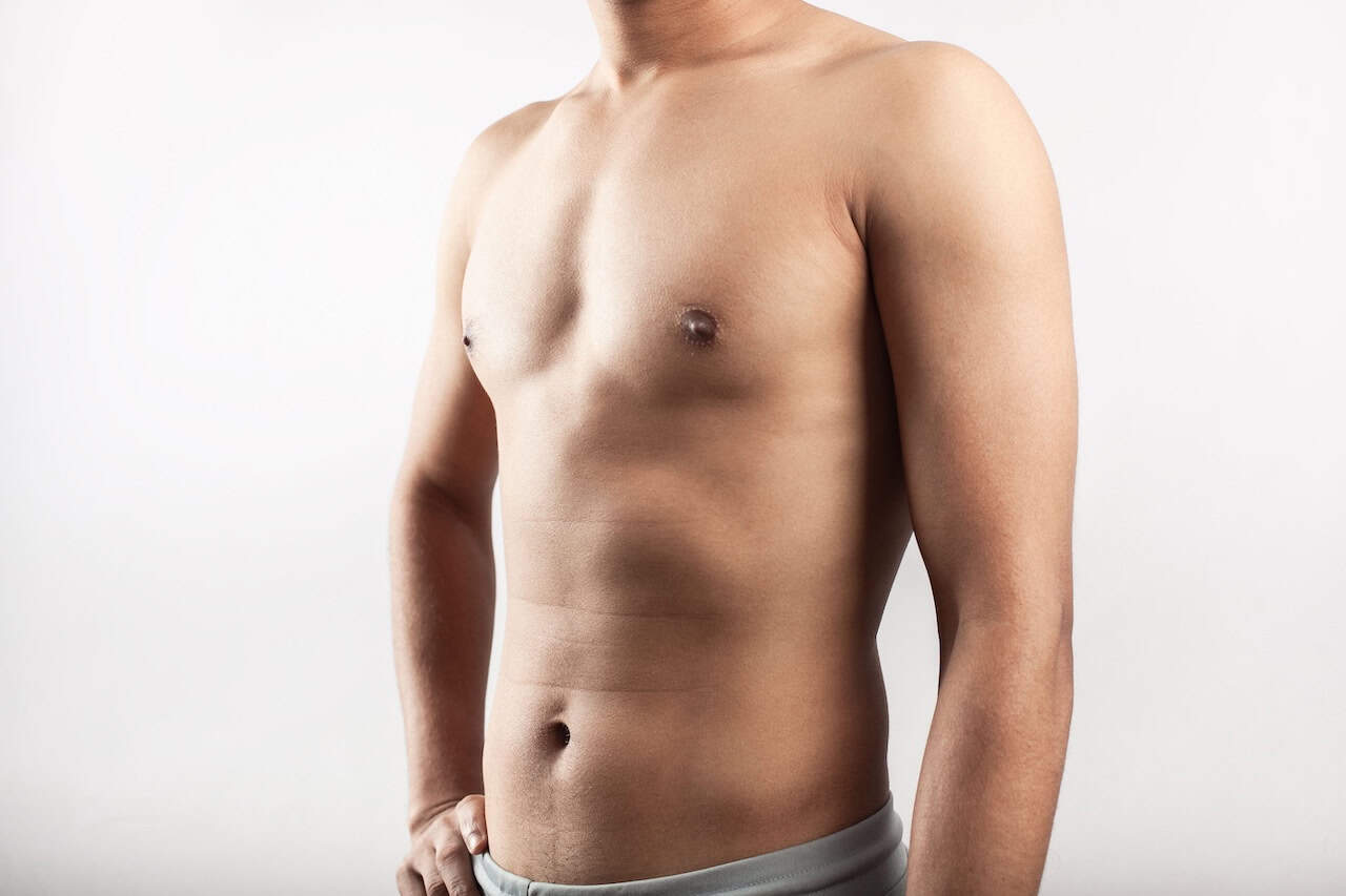 Causes of Gynecomastia