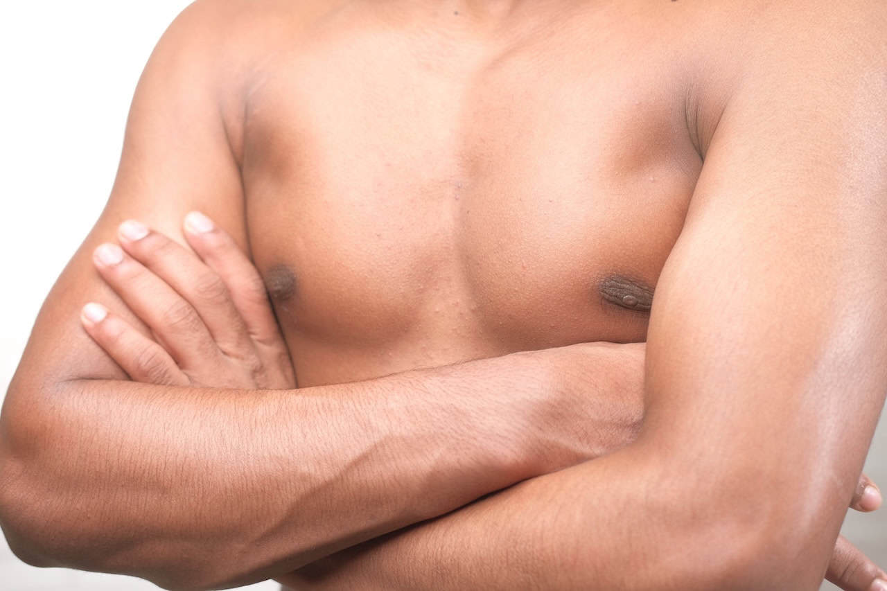 FAQs About Gynecomastia