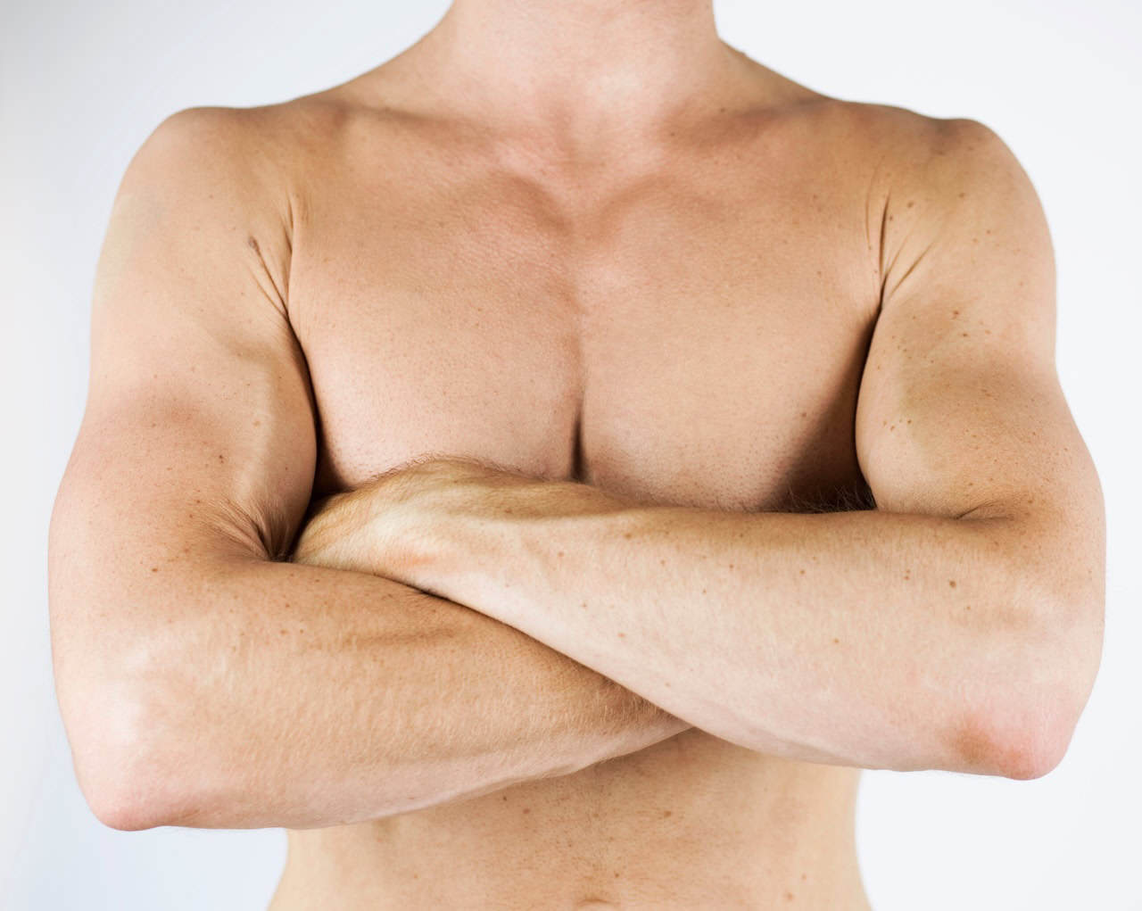 Gynecomastia Overview