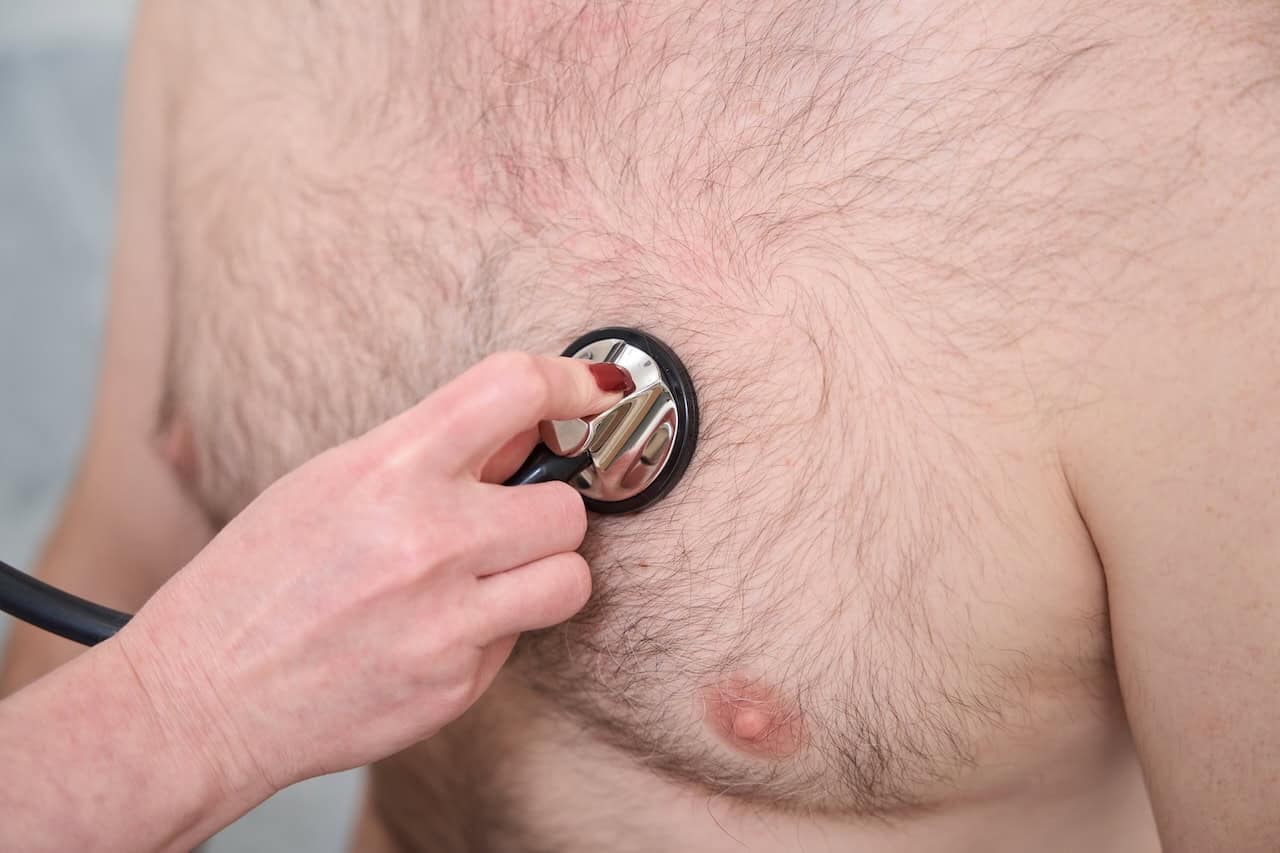 Medical Causes Gynecomastia