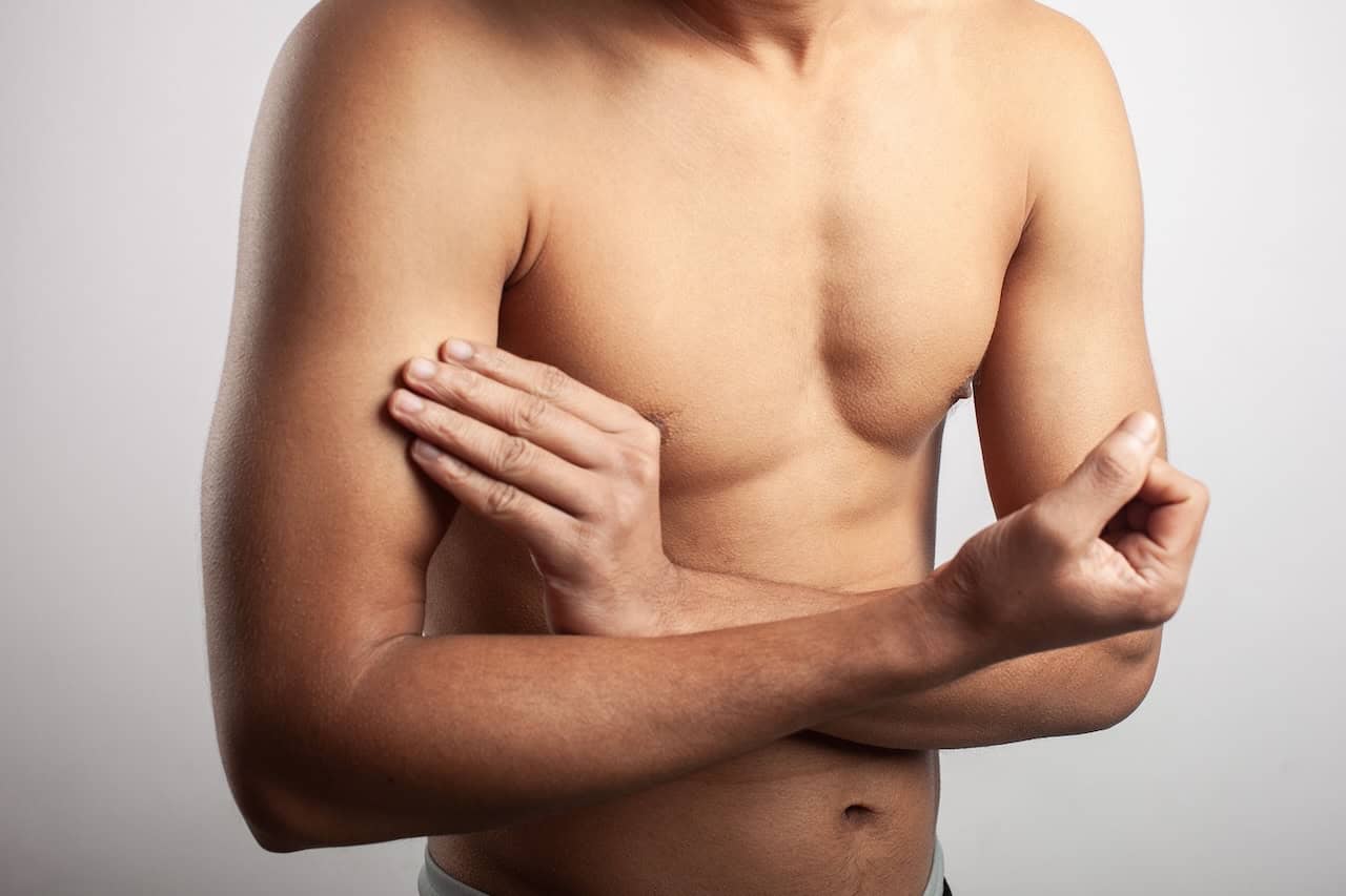 Teenager Gynecomastia Surgery