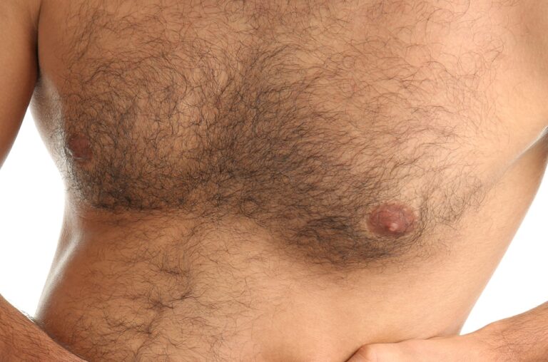 close up of male breast gland growth