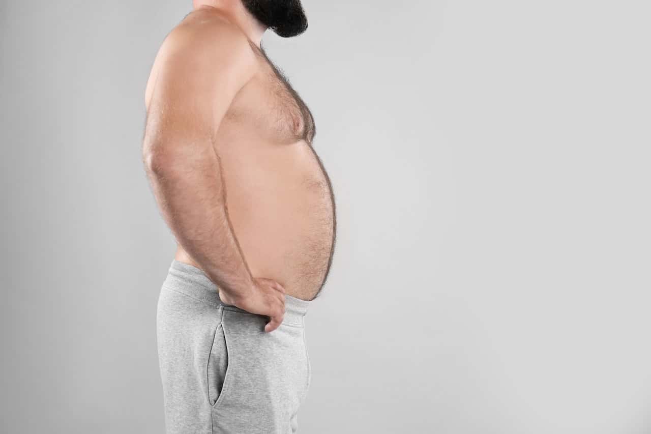 Gynecomastia After Weight Loss