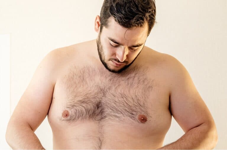 young overweight male with chest growth
