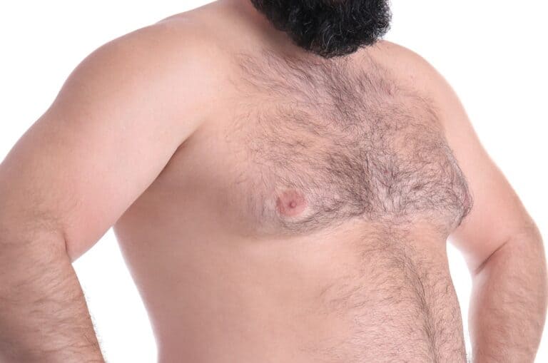 shirtless man showing breast enlargement