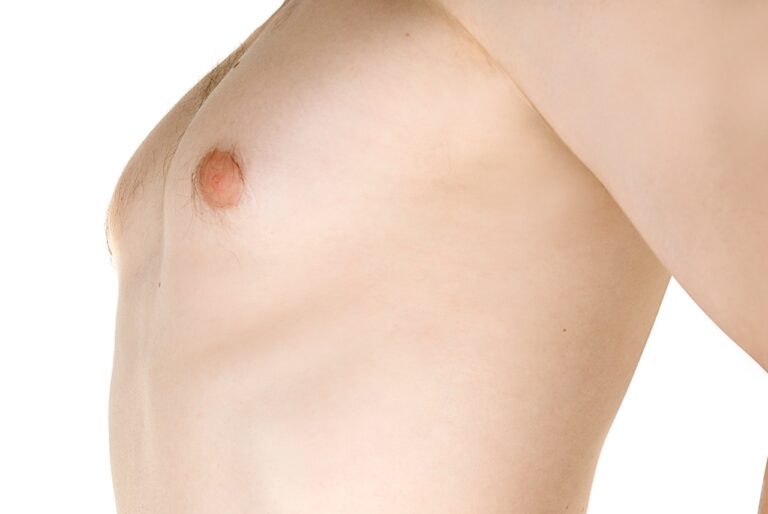 close up of chest enlargement of a young man