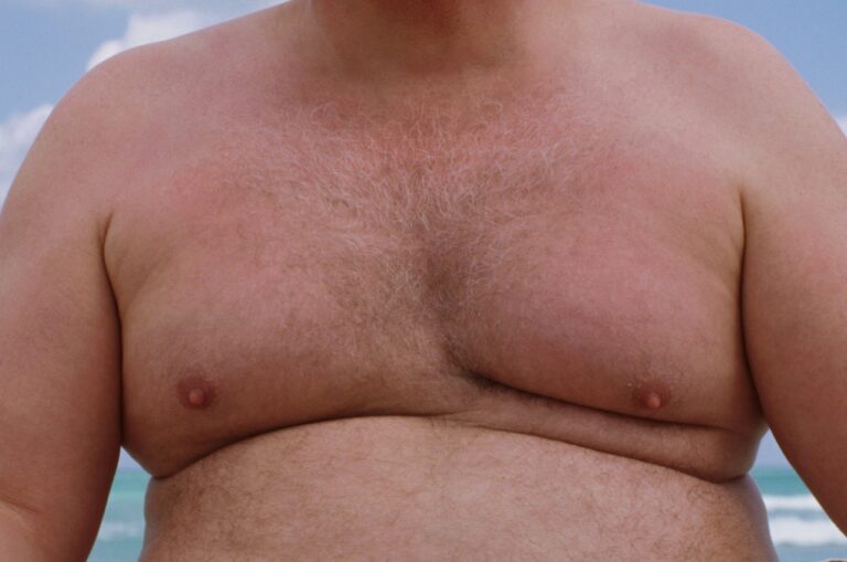 overweight man shirtless outside