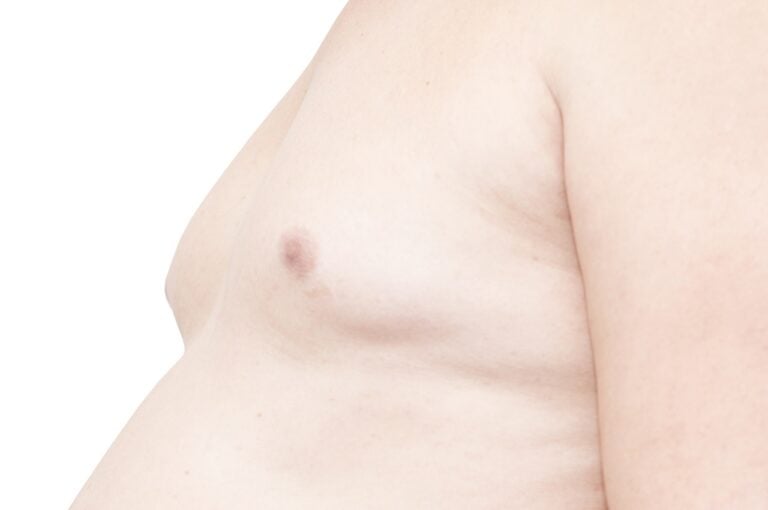 sideview of fat man shirtless