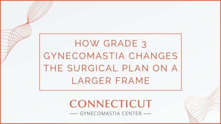 Case Study: How Grade 3 Gynecomastia Changes the Surgical Plan on a Larger Frame