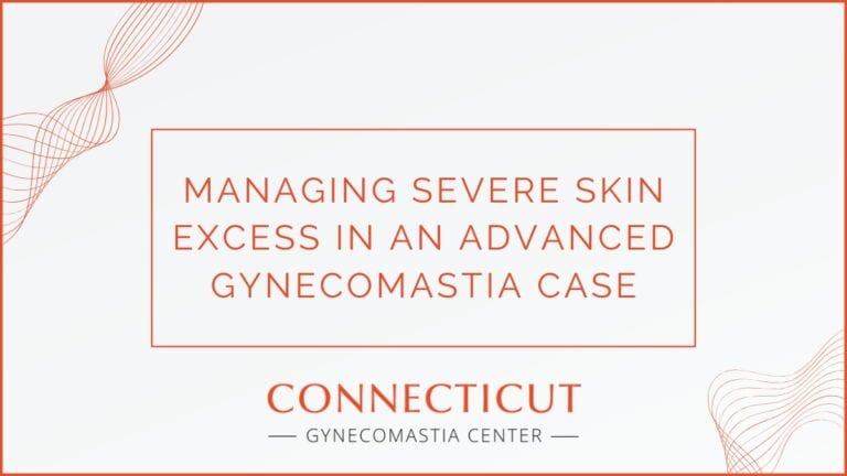 Case Study: Managing Severe Skin Excess in an Advanced Gynecomastia Case