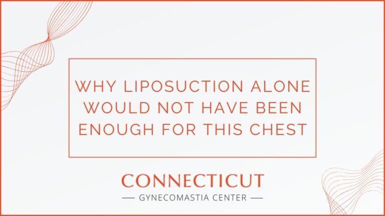 Case Study: Why Liposuction Alone Would Not Have Been Enough for This Chest