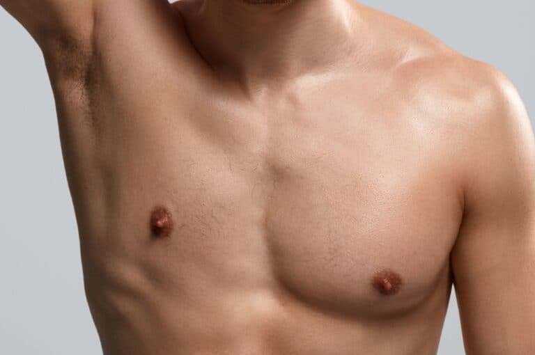 close up of a man's asymmetrical chest growth